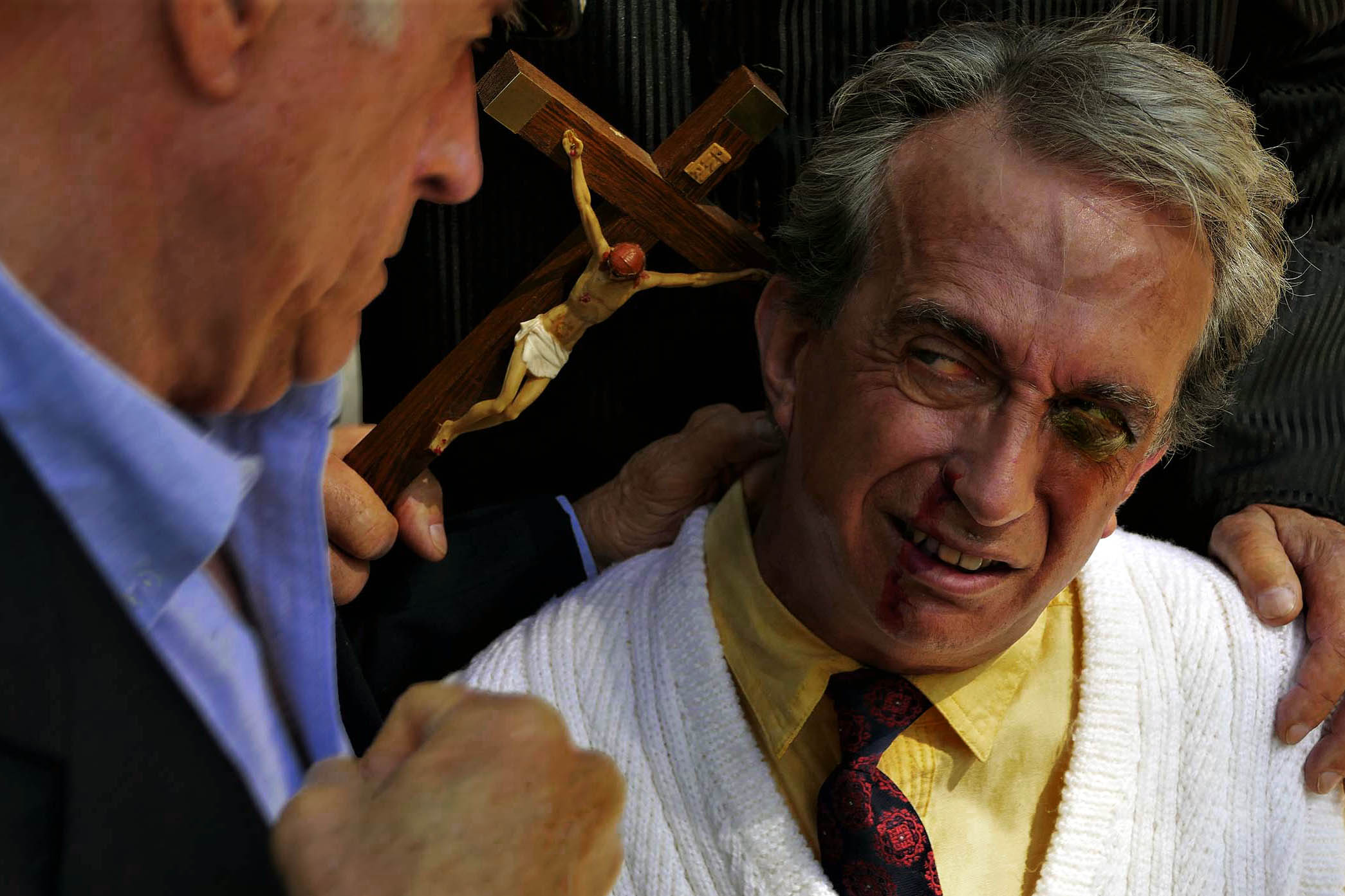 a man with black eyes and another man threatening him with a closed fist.